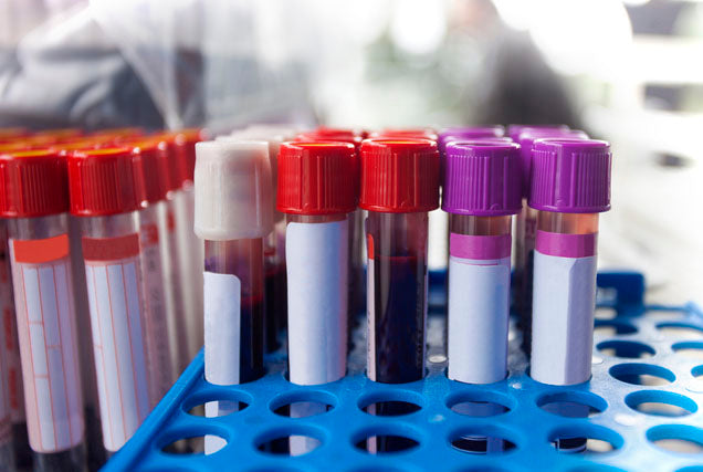 Comprehensive Blood Panel and Salivary Melatonin & Cortisol Profile