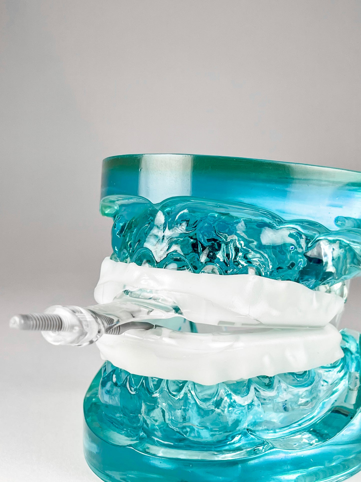 MyTap Mandibular Advancement Device