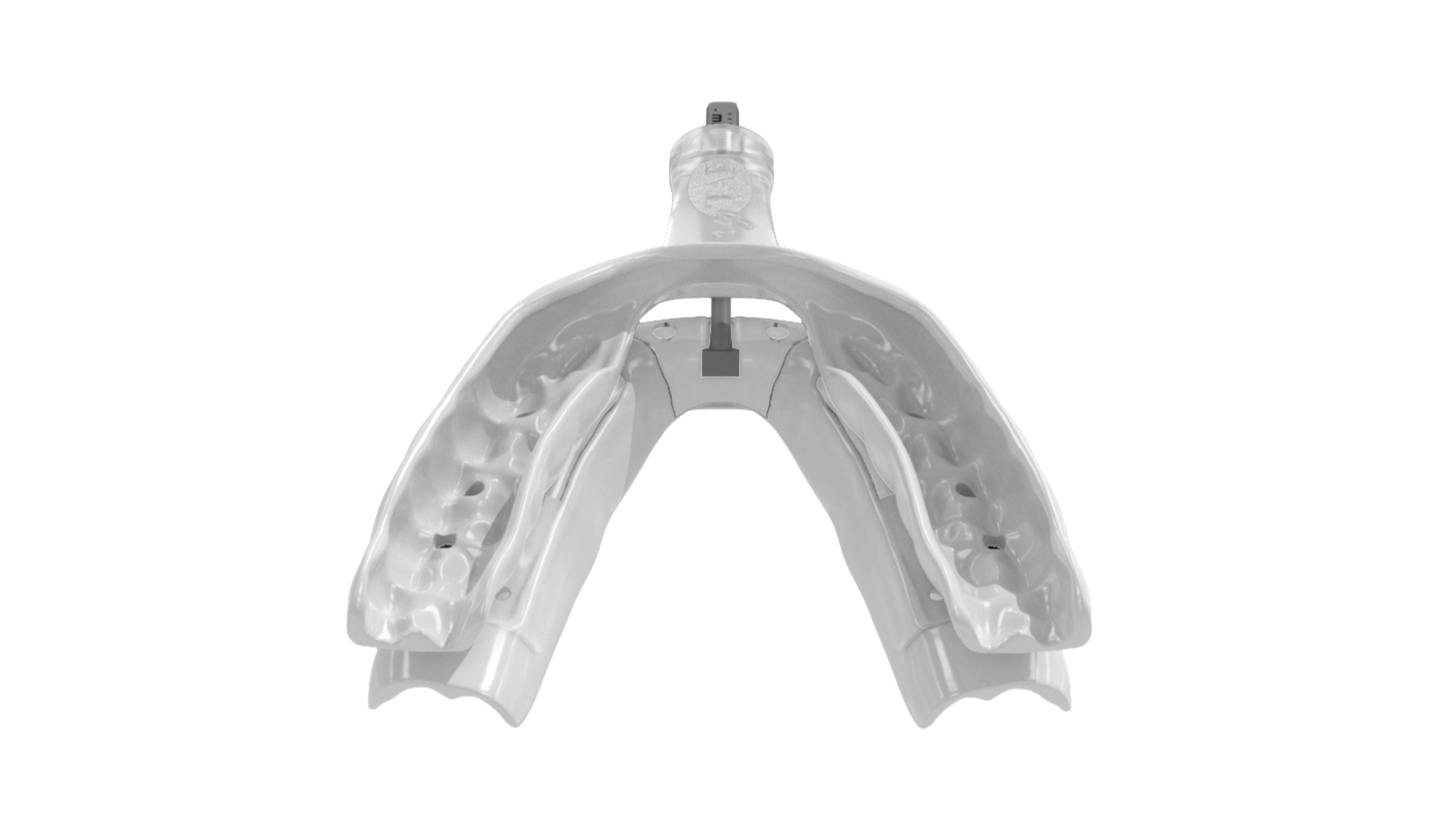 MyTap Mandibular Advancement Device