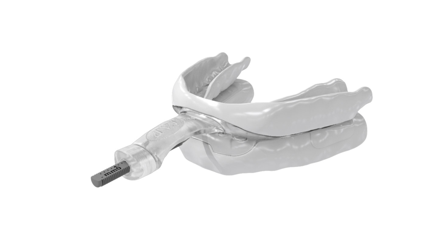 MyTap Mandibular Advancement Device