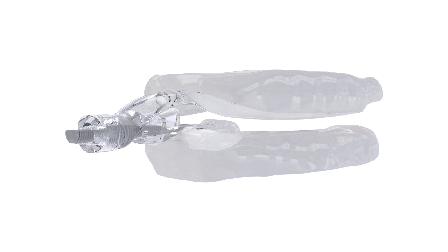 MyTap Mandibular Advancement Device